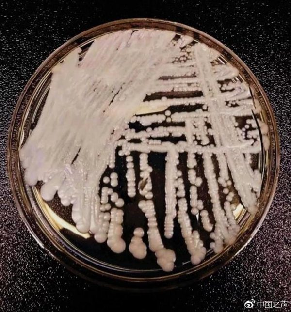 超级真菌刷屏网络 专家:健康人不会感染